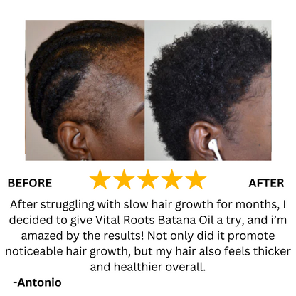 Batana Natural Hair Growth Oil