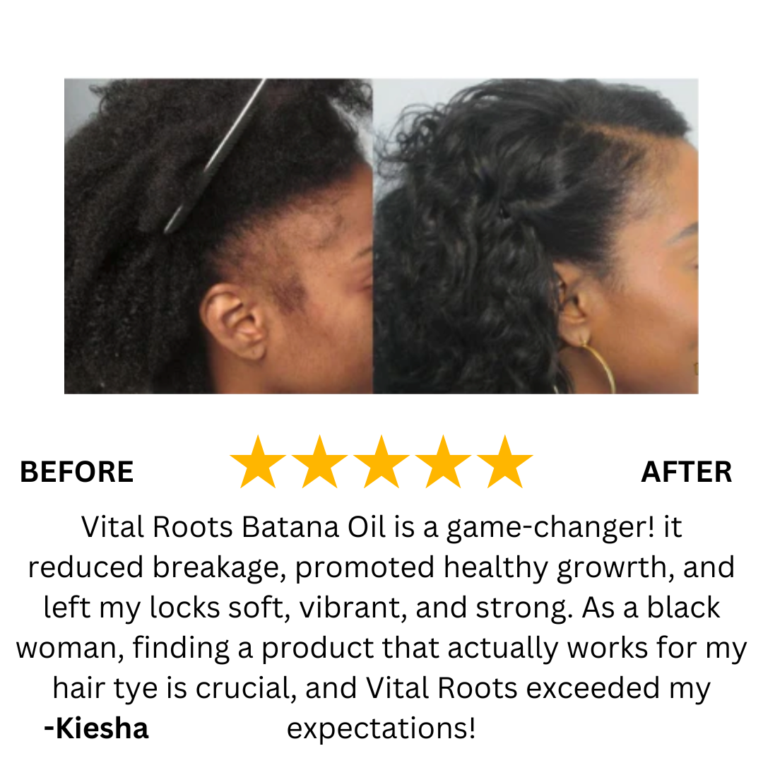 Batana Natural Hair Growth Oil