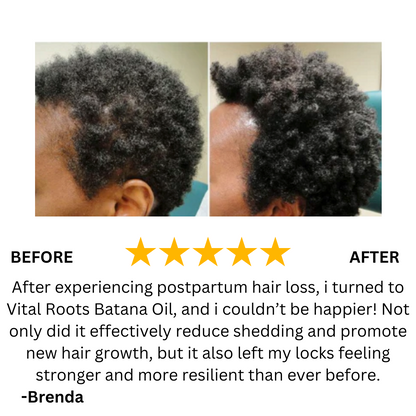 Batana Natural Hair Growth Oil